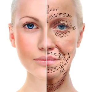 PLASMA (2) PLASMA (2)